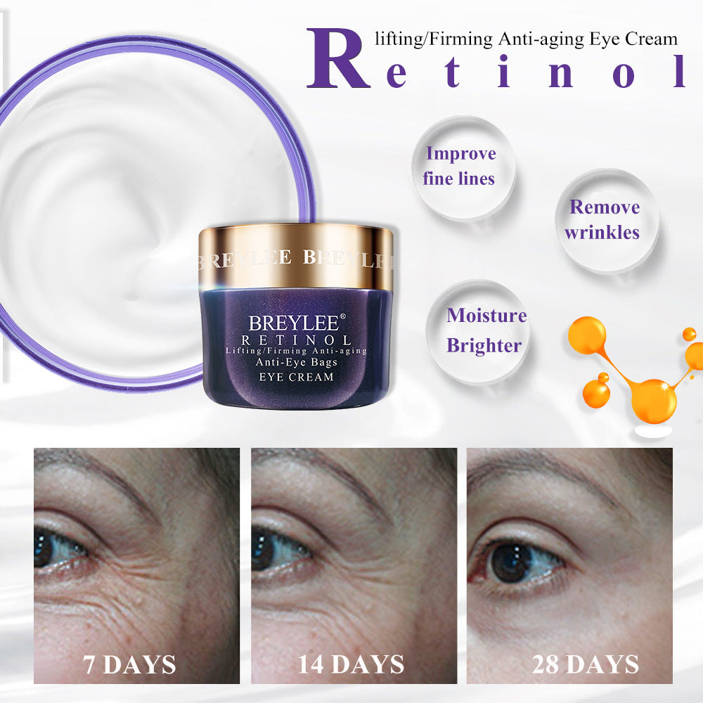 Uric Acid Lotion Moisturizing VC Eye Cream