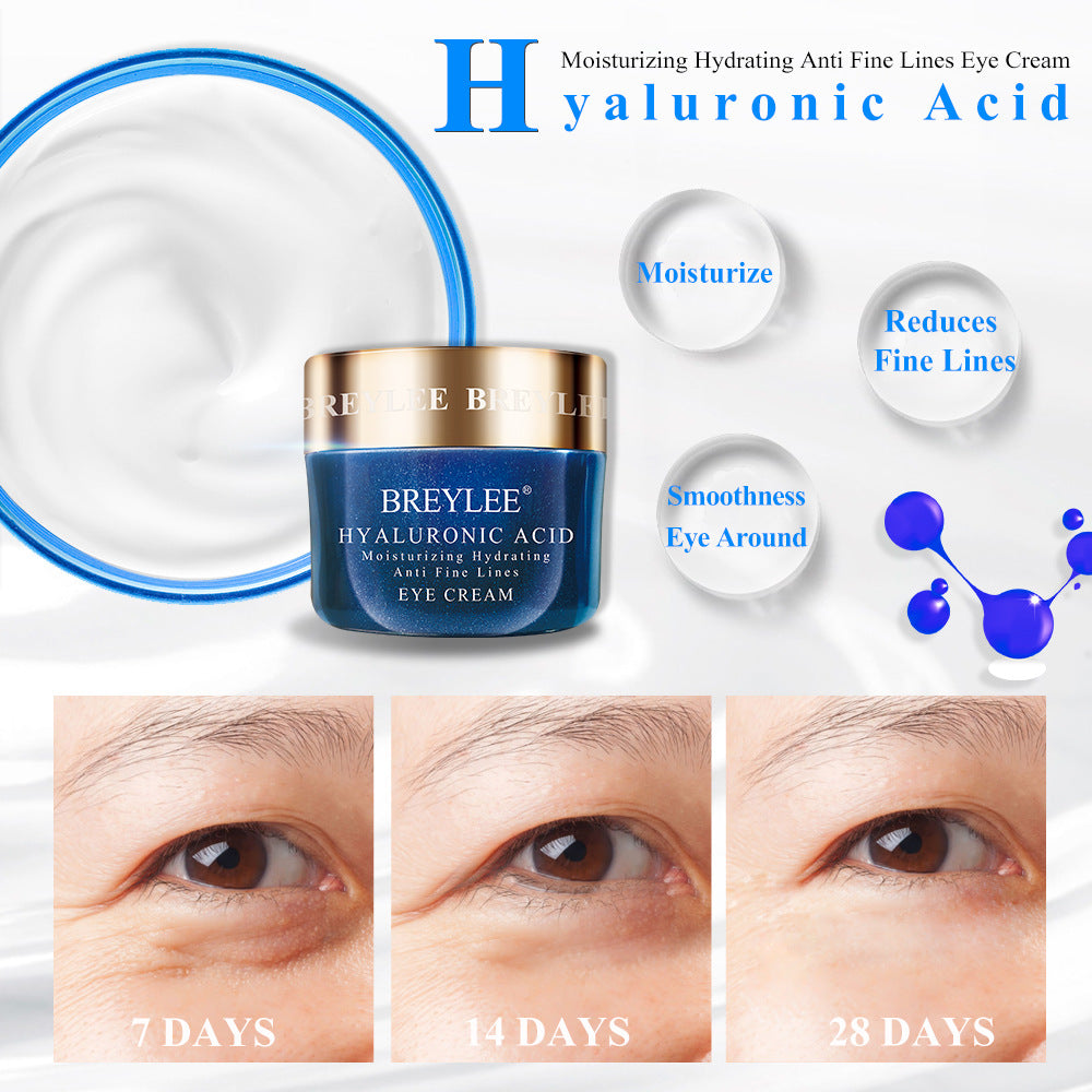Uric Acid Lotion Moisturizing VC Eye Cream